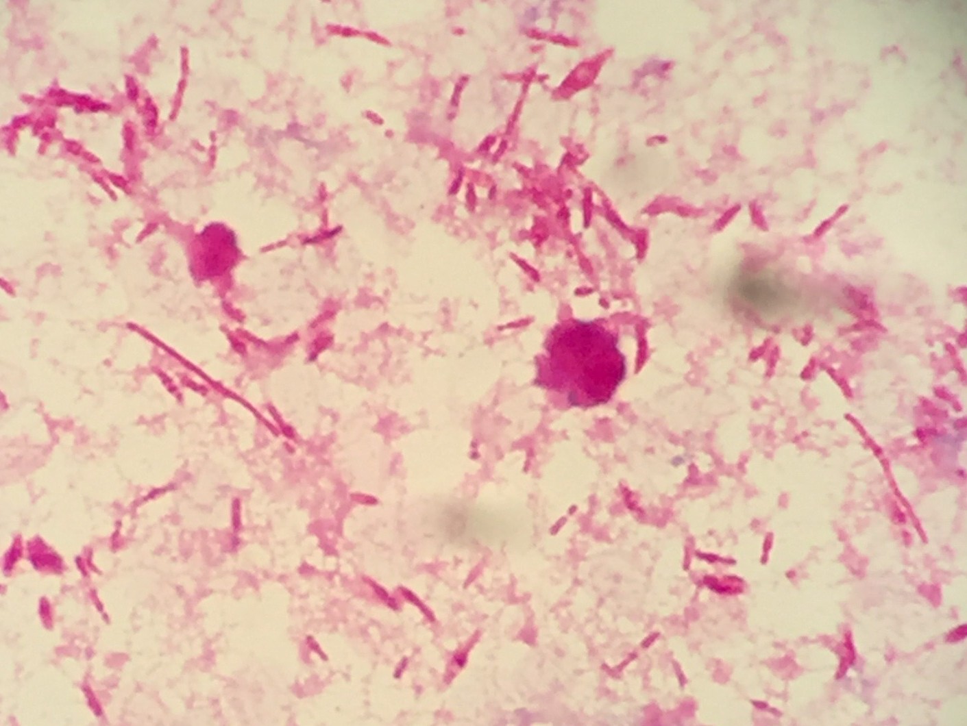 Bacteroides Uniformis